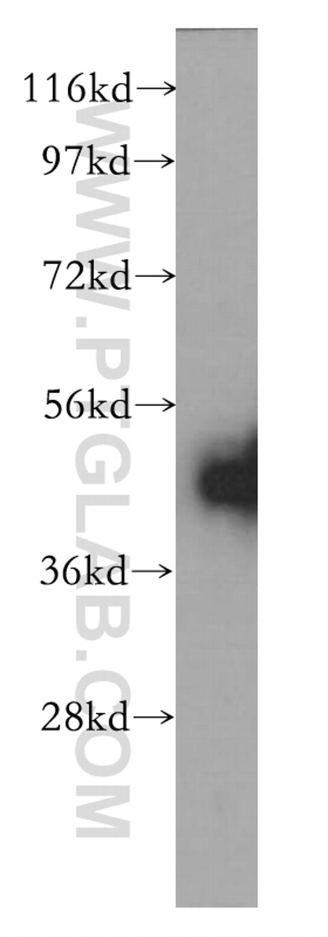 Kininogen 1 Antibody in Western Blot (WB)