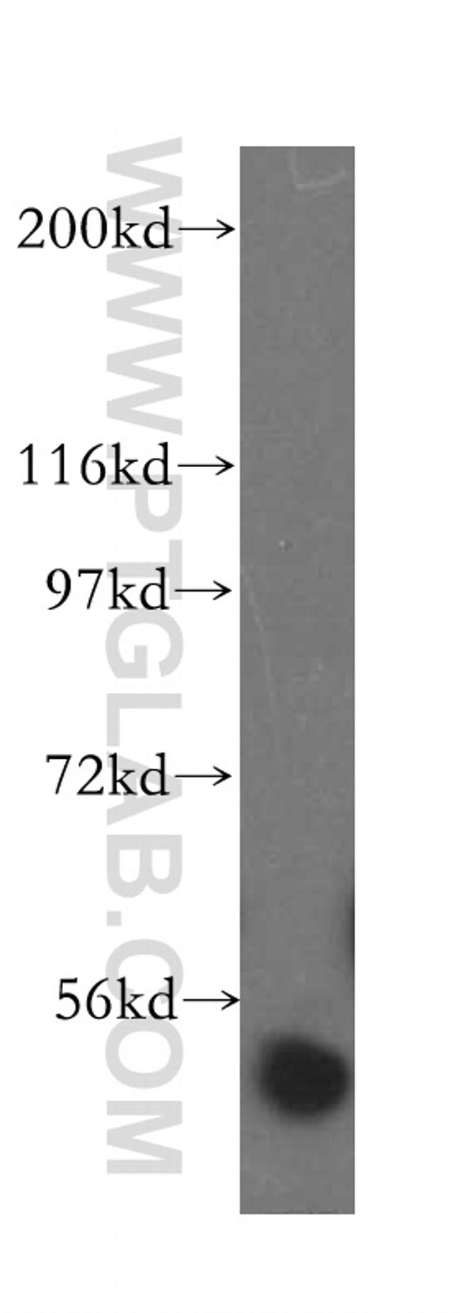 Kininogen 1 Antibody in Western Blot (WB)