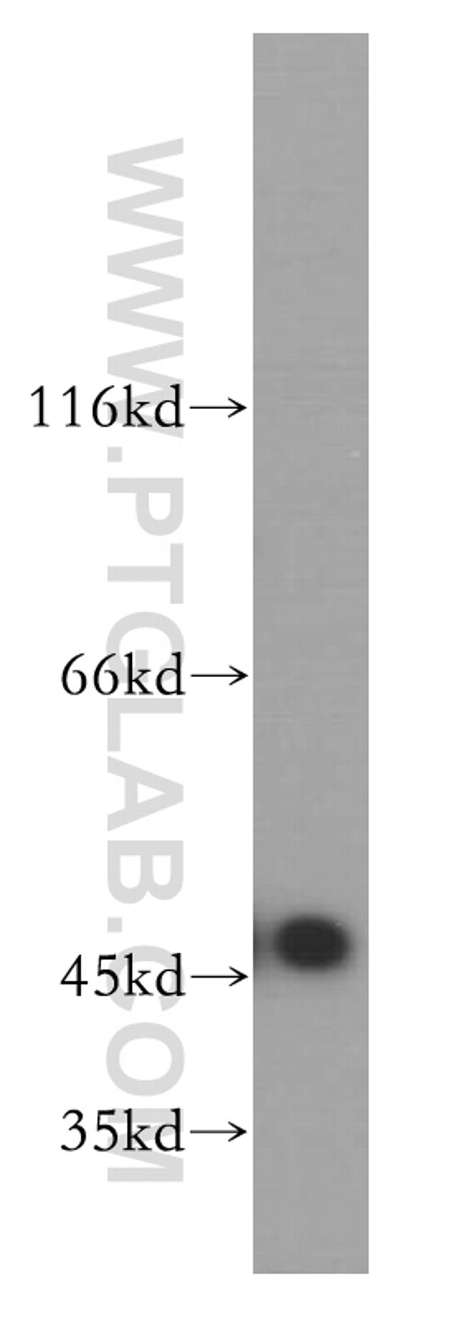 Kininogen 1 Antibody in Western Blot (WB)