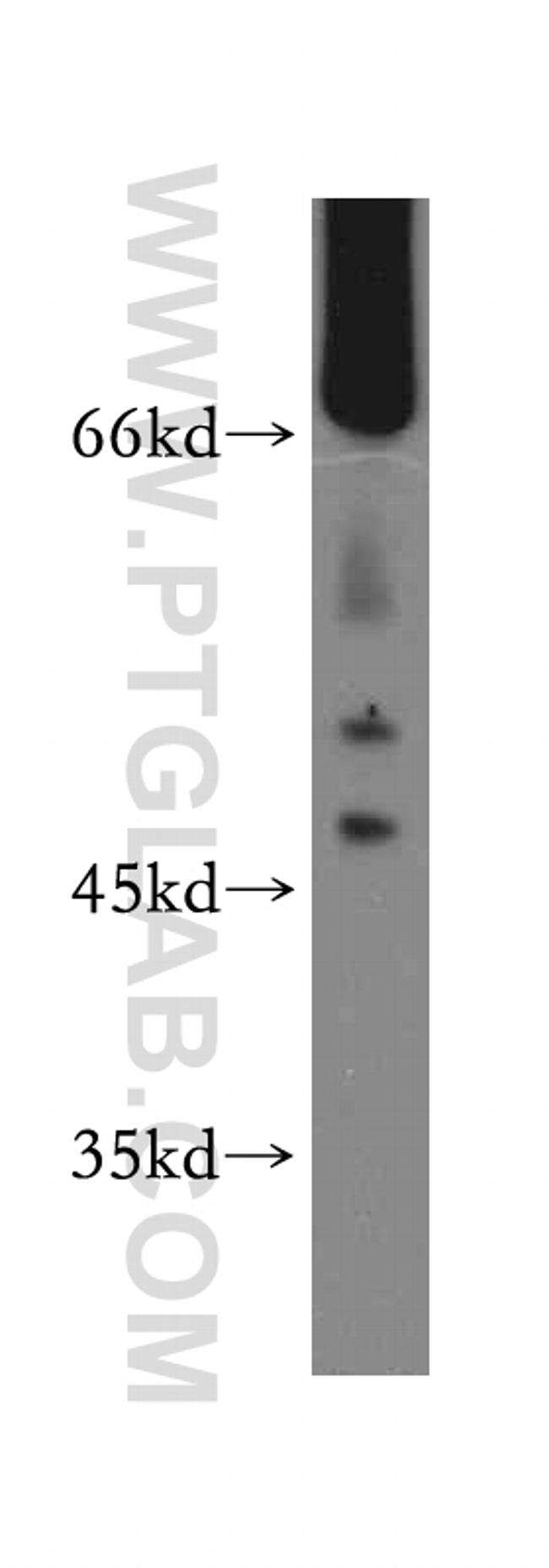 Kininogen 1 Antibody in Western Blot (WB)