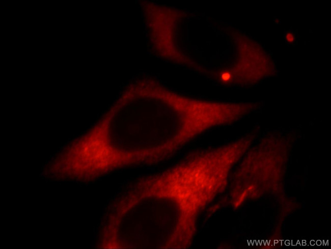 Kininogen 1 Antibody in Immunocytochemistry (ICC/IF)