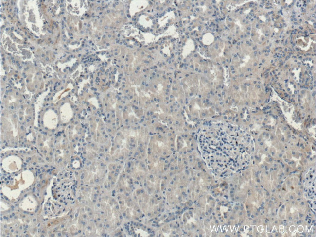 Kininogen 1 Antibody in Immunohistochemistry (Paraffin) (IHC (P))