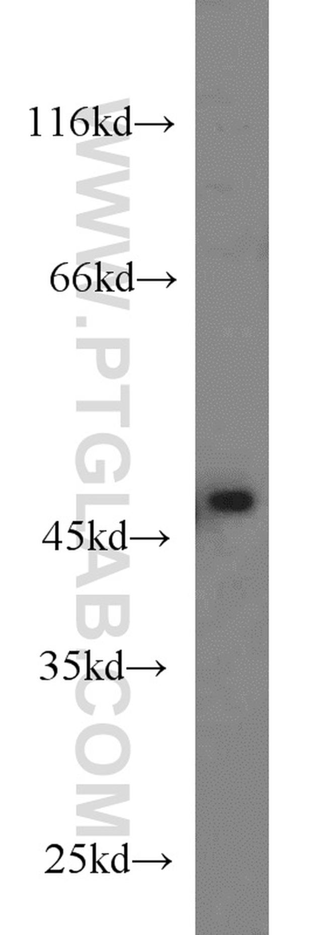 TMEFF2 Antibody in Western Blot (WB)