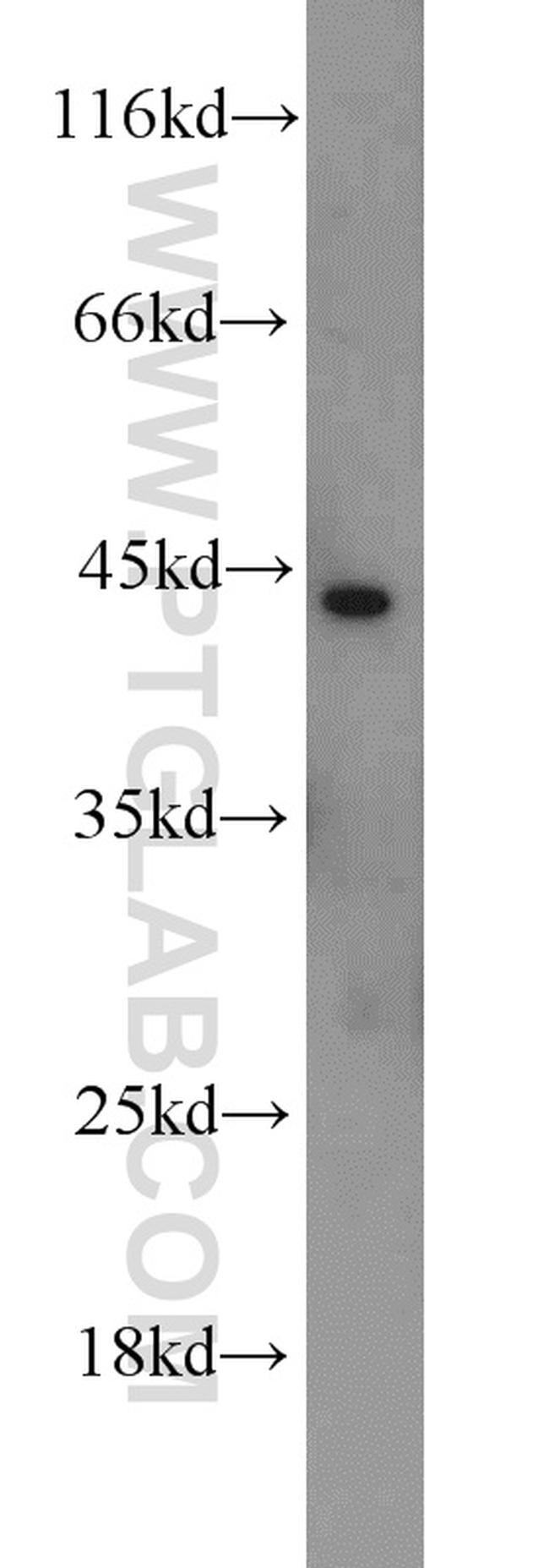 TMEFF2 Antibody in Western Blot (WB)