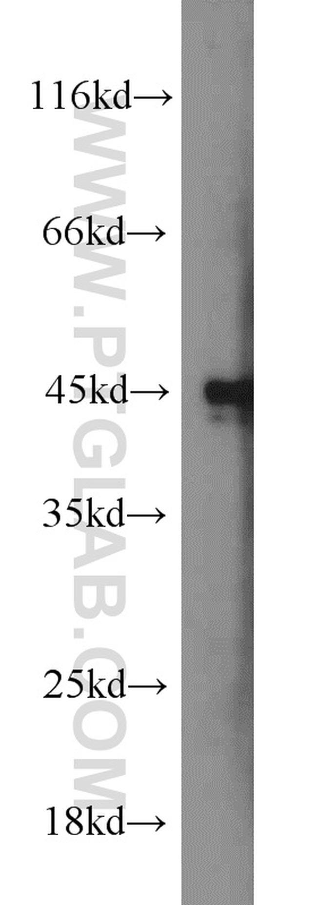 TMEFF2 Antibody in Western Blot (WB)