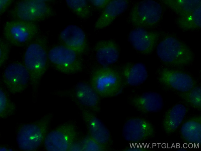 CSPP1 Antibody in Immunocytochemistry (ICC/IF)