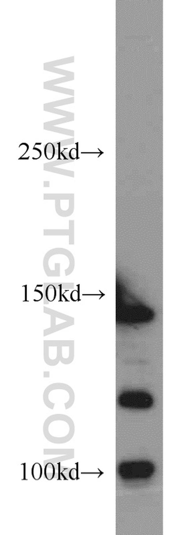 CSPP1 Antibody in Western Blot (WB)