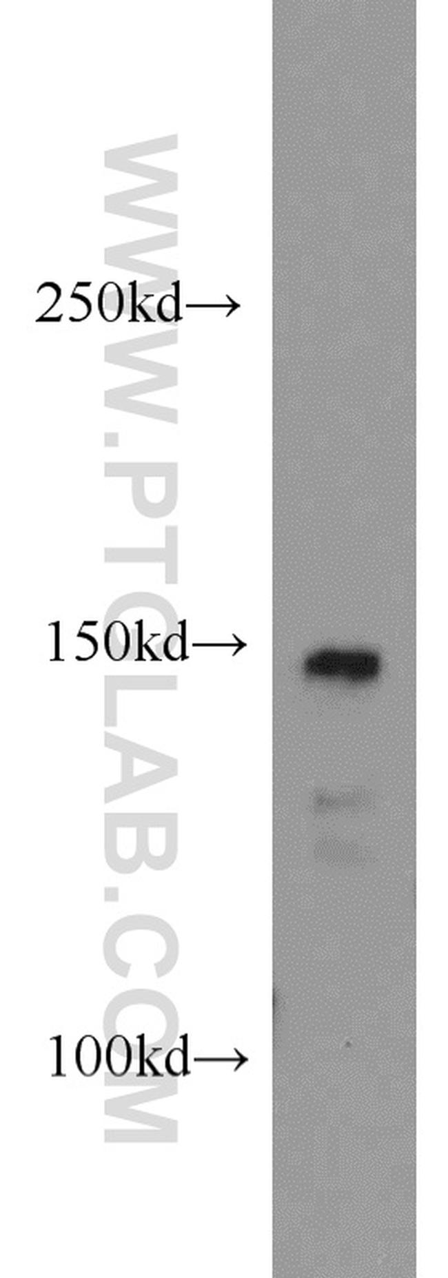 CSPP1 Antibody in Western Blot (WB)