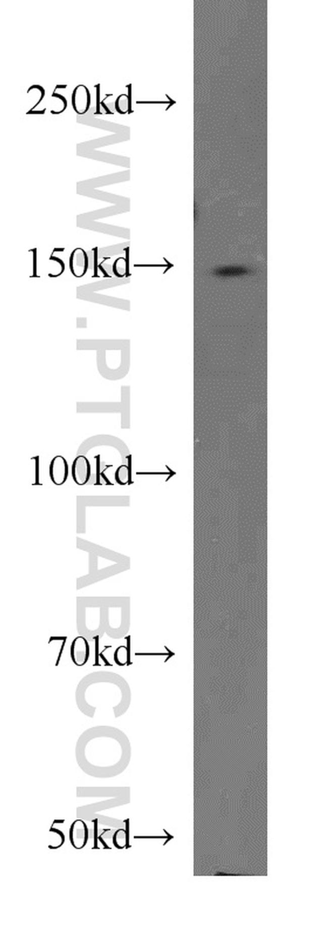 CSPP1 Antibody in Western Blot (WB)