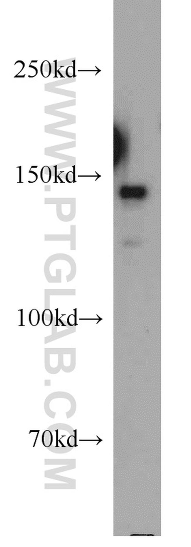 CSPP1 Antibody in Western Blot (WB)