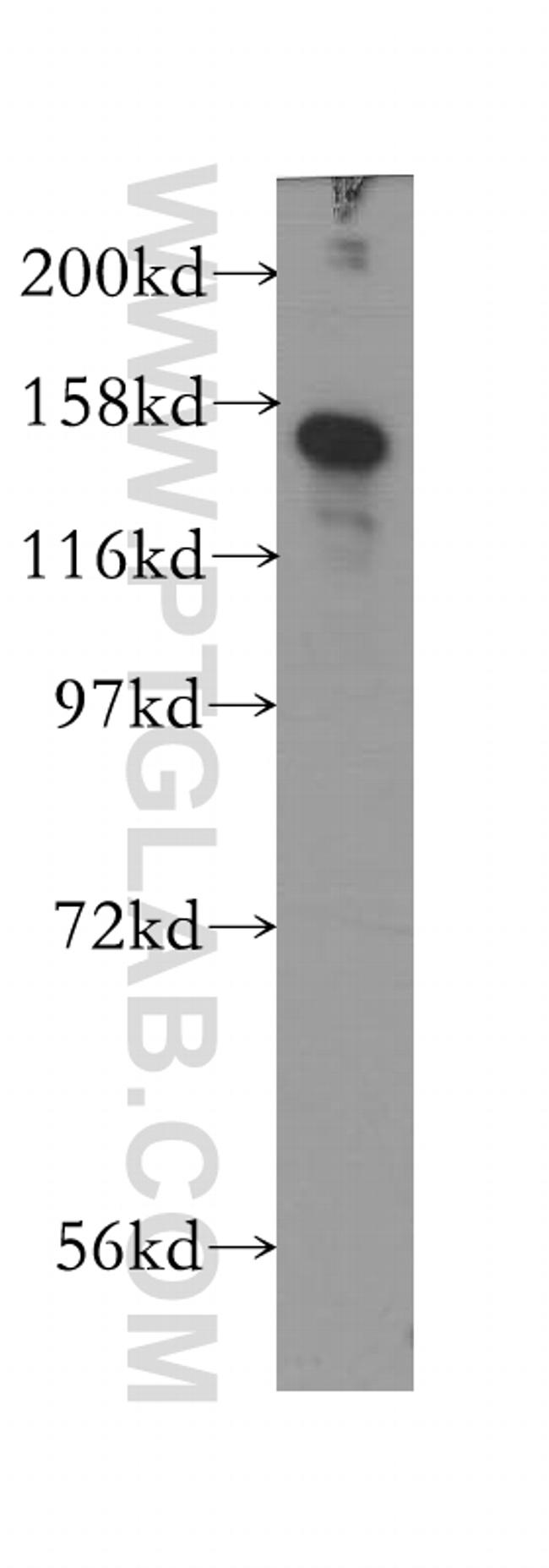 CSPP1 Antibody in Western Blot (WB)