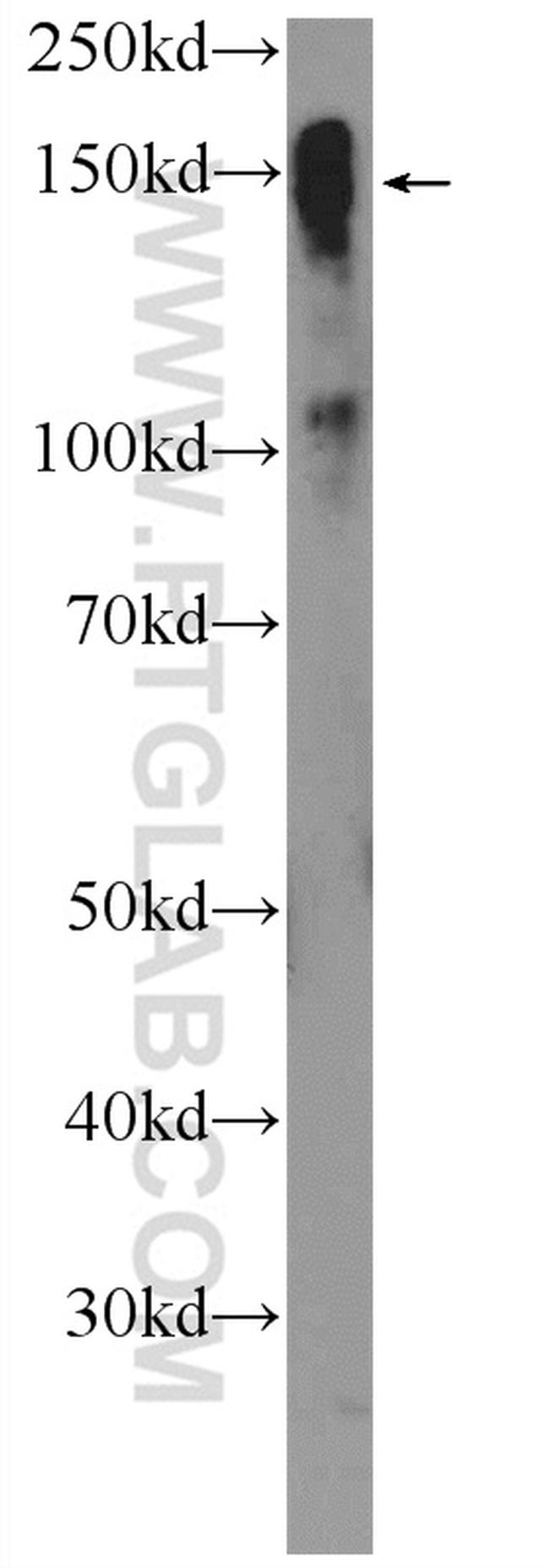 CSPP1 Antibody in Western Blot (WB)