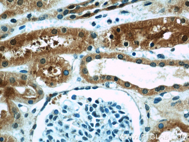 PRAP1 Antibody in Immunohistochemistry (Paraffin) (IHC (P))