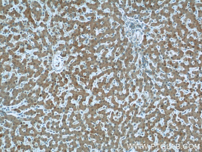 PRAP1 Antibody in Immunohistochemistry (Paraffin) (IHC (P))