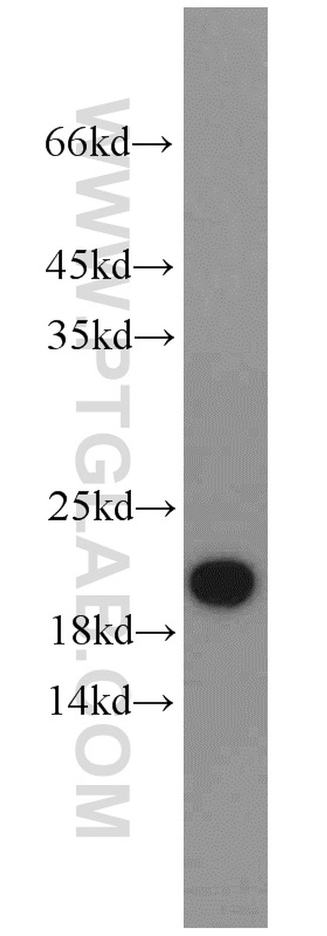 PRAP1 Antibody in Western Blot (WB)