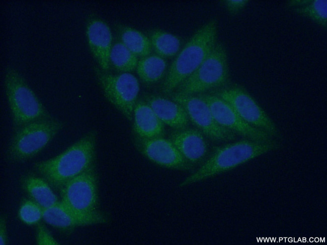 COMMD1 Antibody in Immunocytochemistry (ICC/IF)