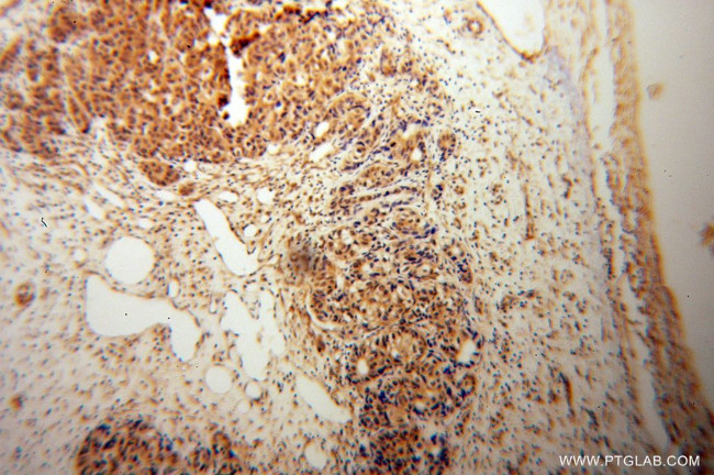 COMMD1 Antibody in Immunohistochemistry (Paraffin) (IHC (P))