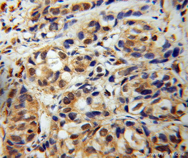 COMMD1 Antibody in Immunohistochemistry (Paraffin) (IHC (P))