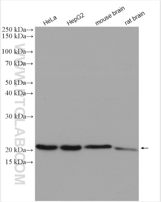 COMMD1 Antibody in Western Blot (WB)