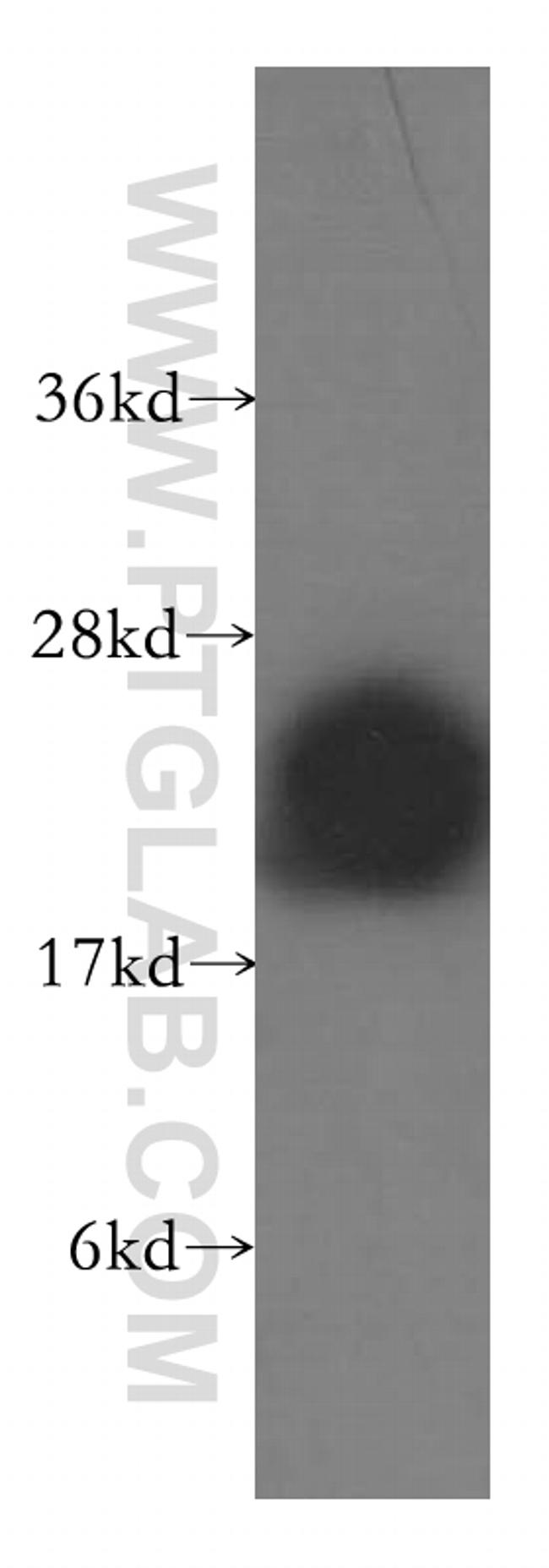 COMMD1 Antibody in Western Blot (WB)