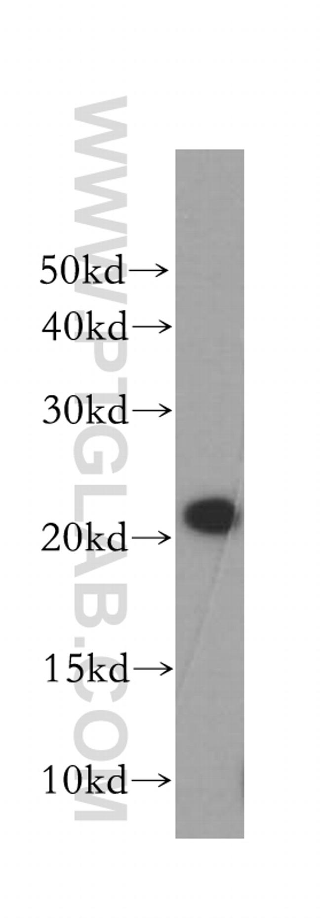 COMMD1 Antibody in Western Blot (WB)