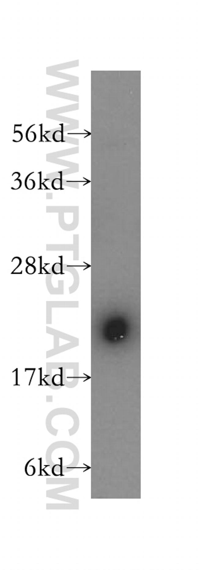 COMMD1 Antibody in Western Blot (WB)