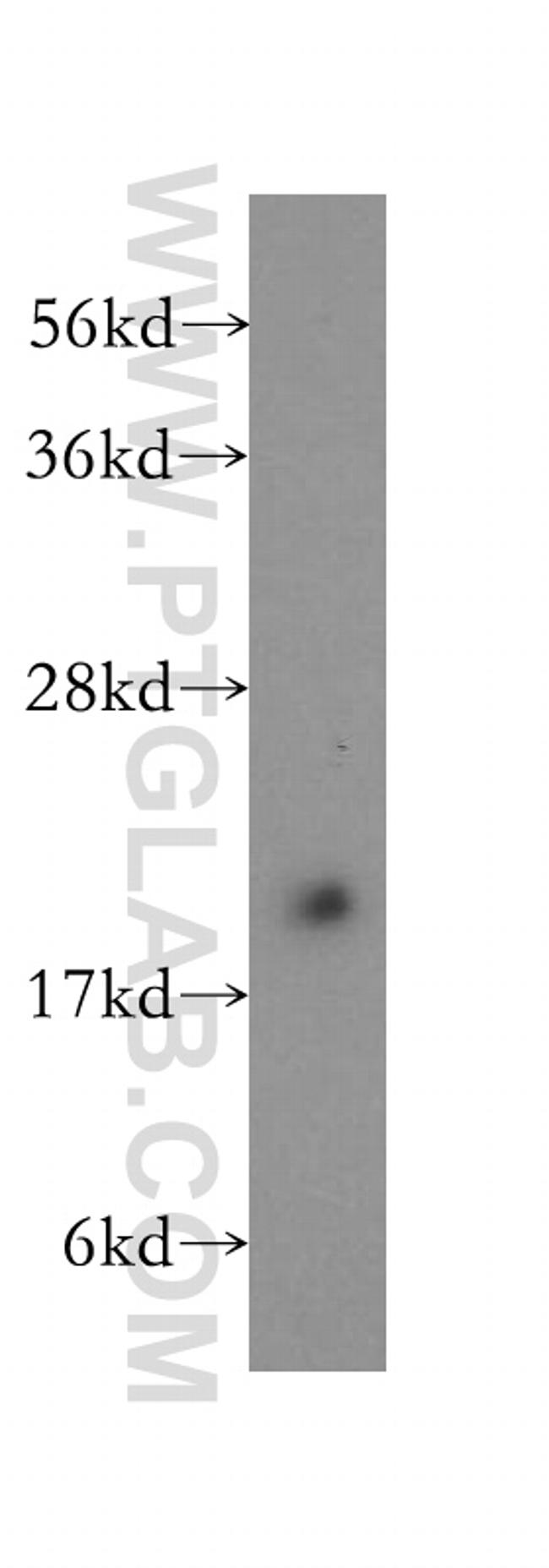 COMMD1 Antibody in Western Blot (WB)