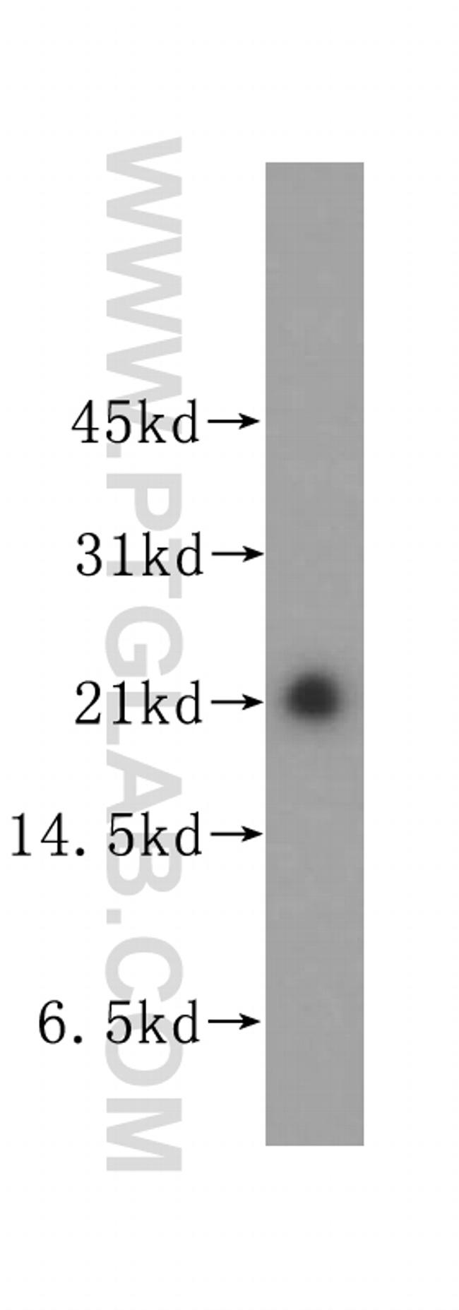 COMMD1 Antibody in Western Blot (WB)