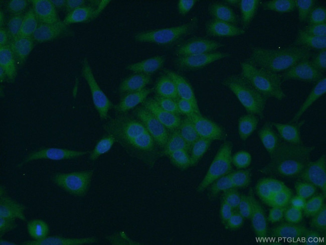 SCHIP1 Antibody in Immunocytochemistry (ICC/IF)