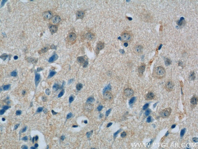 SCHIP1 Antibody in Immunohistochemistry (Paraffin) (IHC (P))