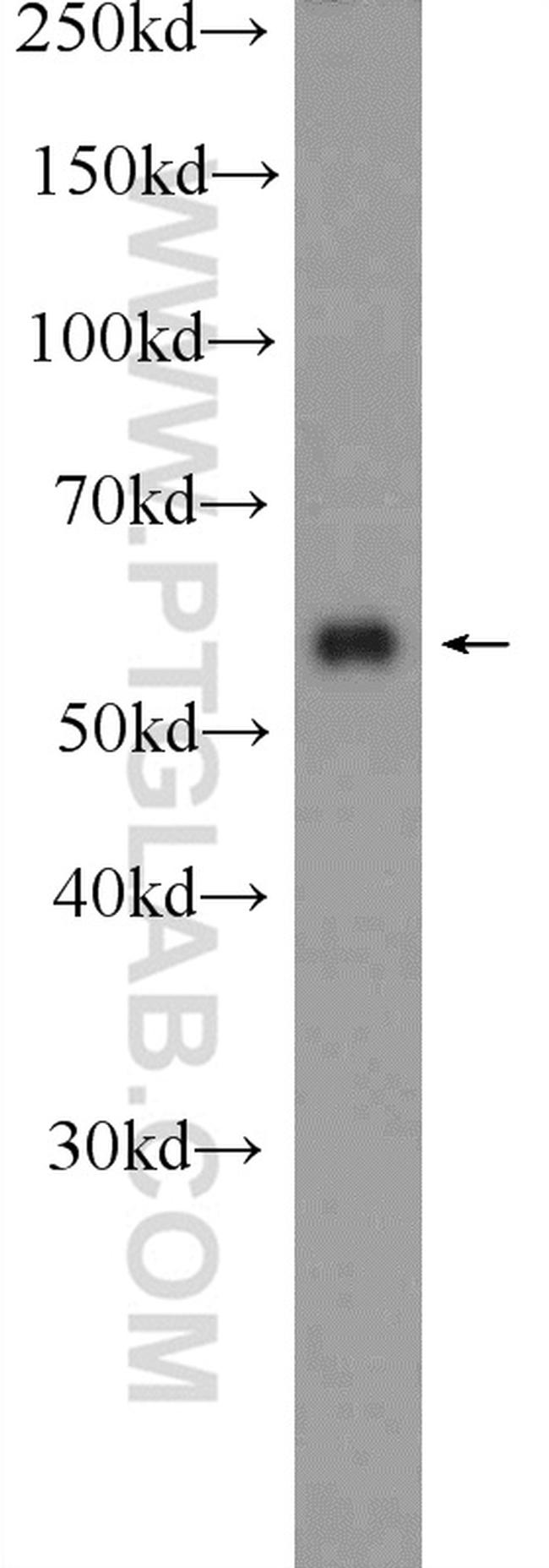 SCHIP1 Antibody in Western Blot (WB)