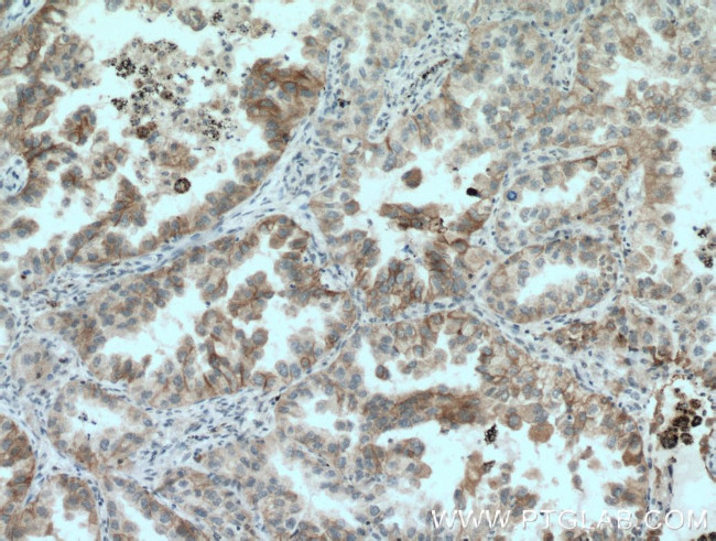 GAS2 Antibody in Immunohistochemistry (Paraffin) (IHC (P))