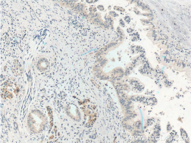 PSMA4 Antibody in Immunohistochemistry (Paraffin) (IHC (P))