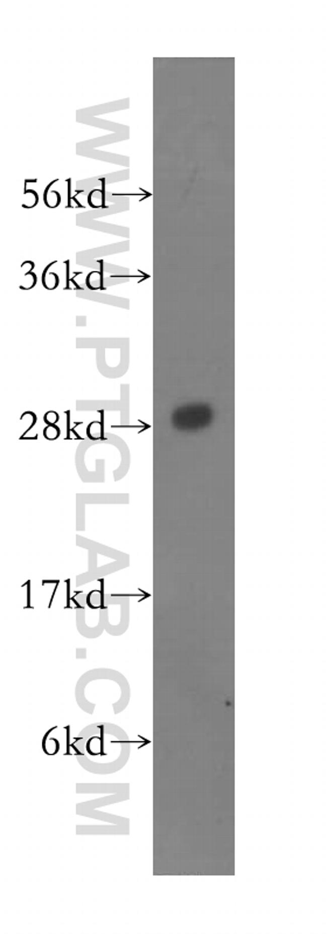 PSMA4 Antibody in Western Blot (WB)