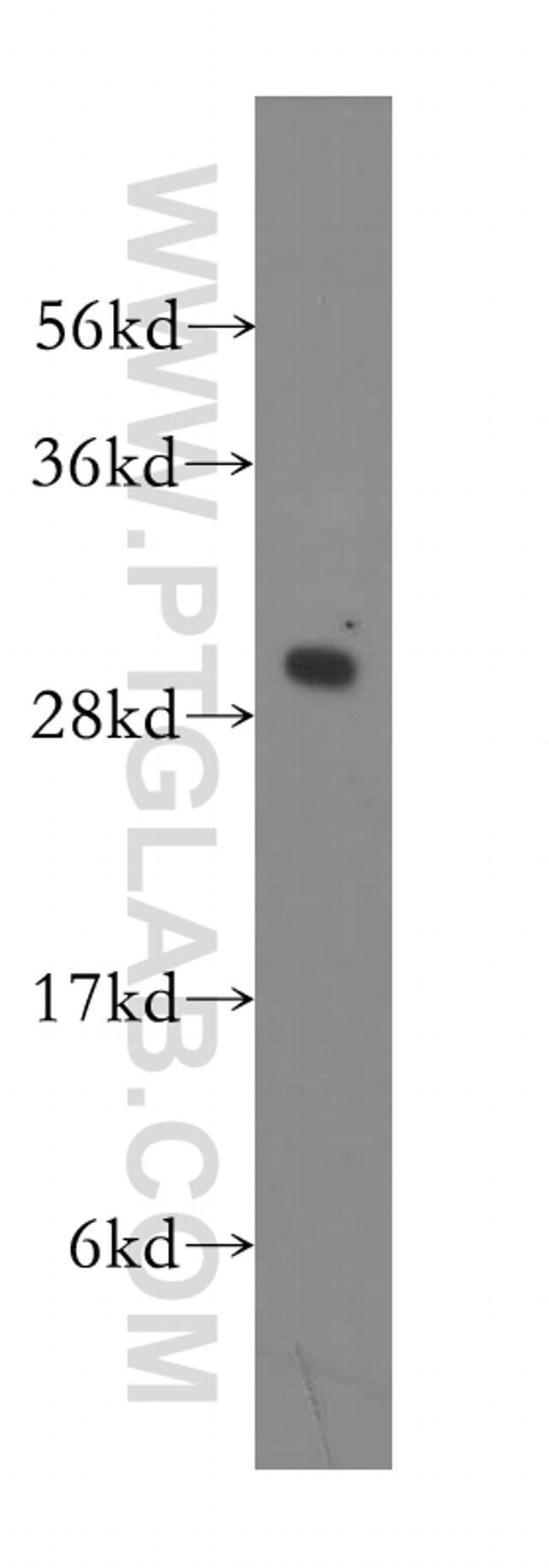 PSMA4 Antibody in Western Blot (WB)