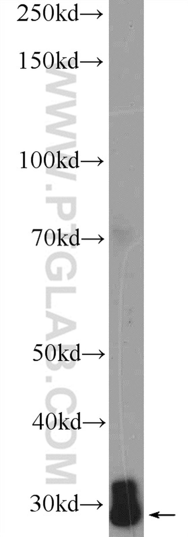 PSMA4 Antibody in Western Blot (WB)