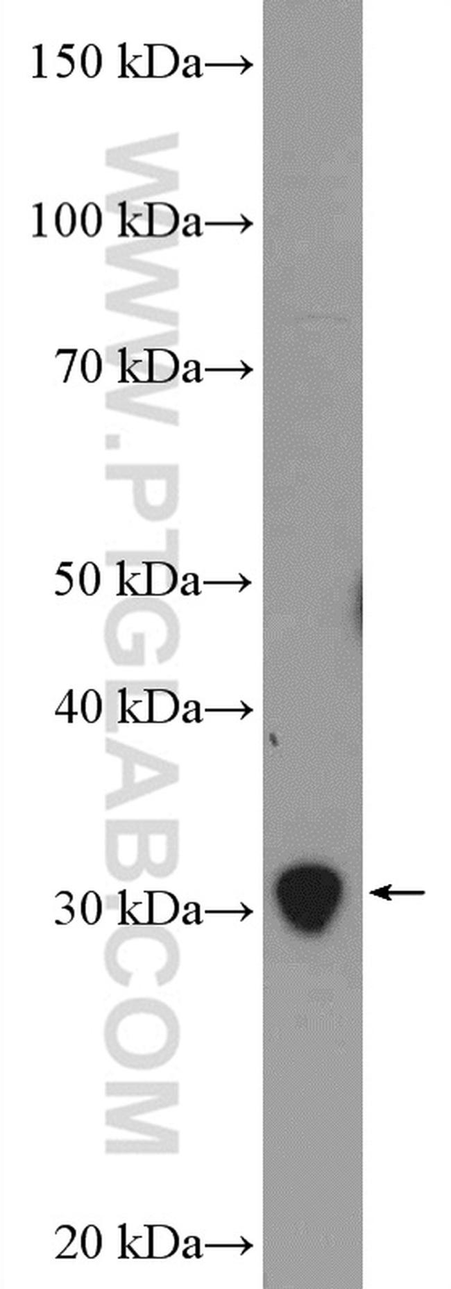 PSMA4 Antibody in Western Blot (WB)