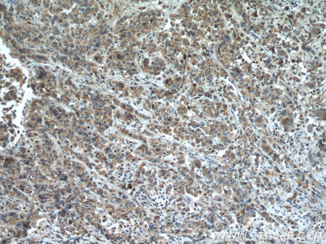 STEAP4 Antibody in Immunohistochemistry (Paraffin) (IHC (P))