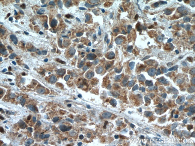 STEAP4 Antibody in Immunohistochemistry (Paraffin) (IHC (P))