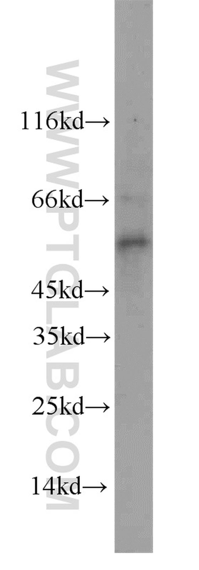 STEAP4 Antibody in Western Blot (WB)