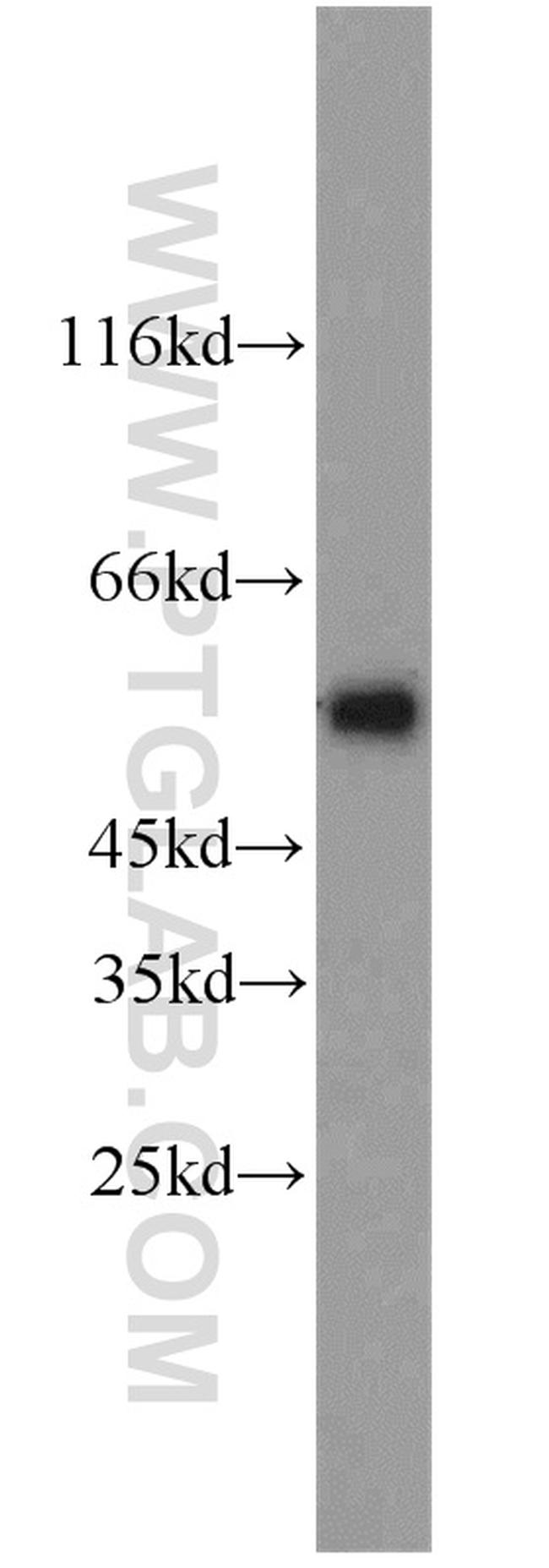 STEAP4 Antibody in Western Blot (WB)