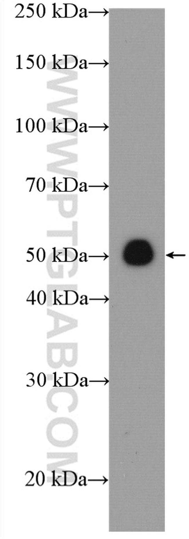 STEAP4 Antibody in Western Blot (WB)