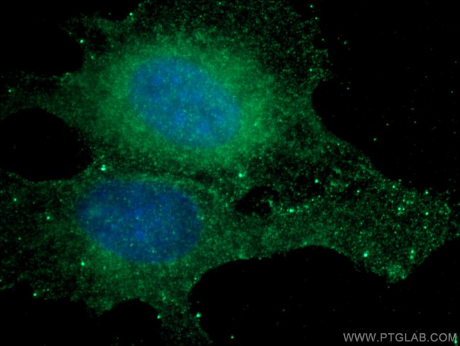 RAB5A Antibody in Immunocytochemistry (ICC/IF)