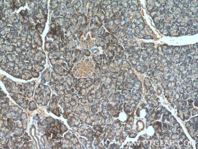 RAB5A Antibody in Immunohistochemistry (Paraffin) (IHC (P))