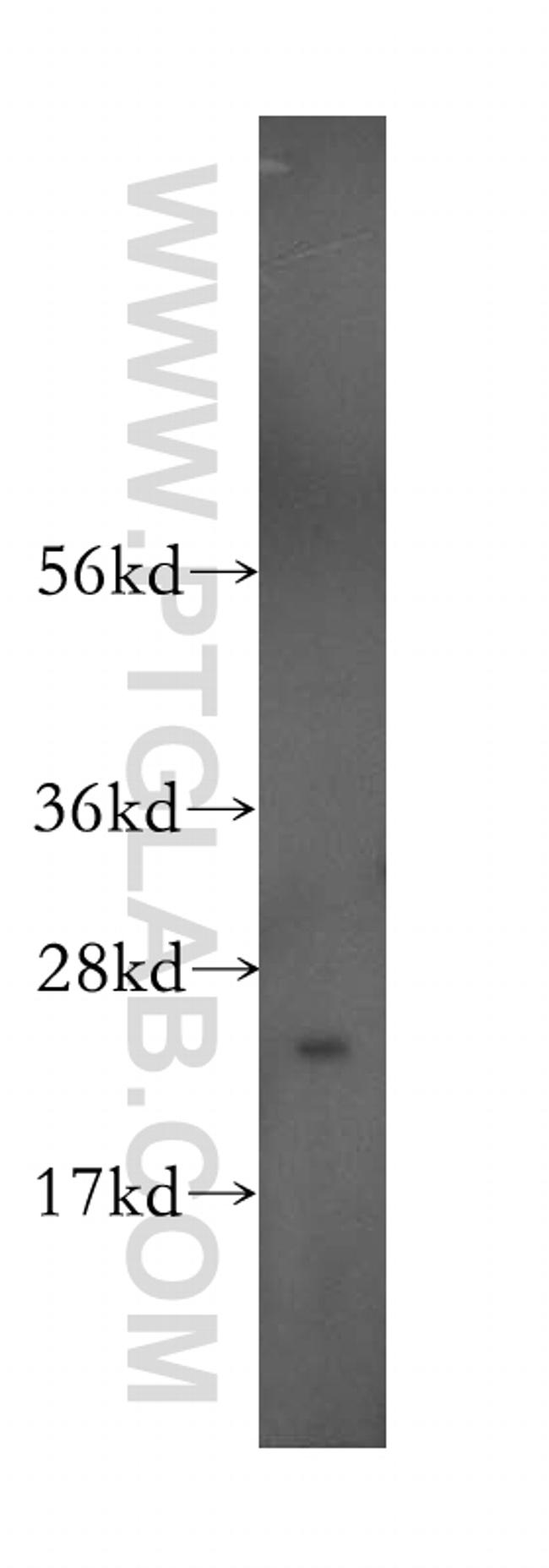 RAB5A Antibody in Western Blot (WB)