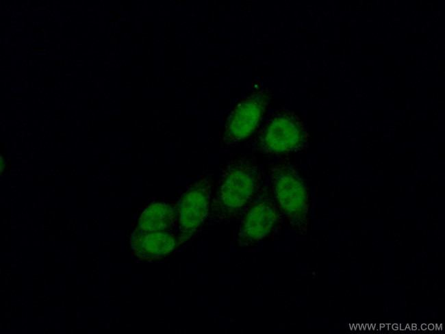 CBP20 Antibody in Immunocytochemistry (ICC/IF)