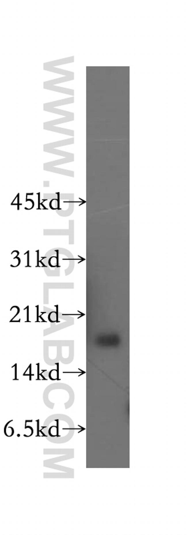 CBP20 Antibody in Western Blot (WB)