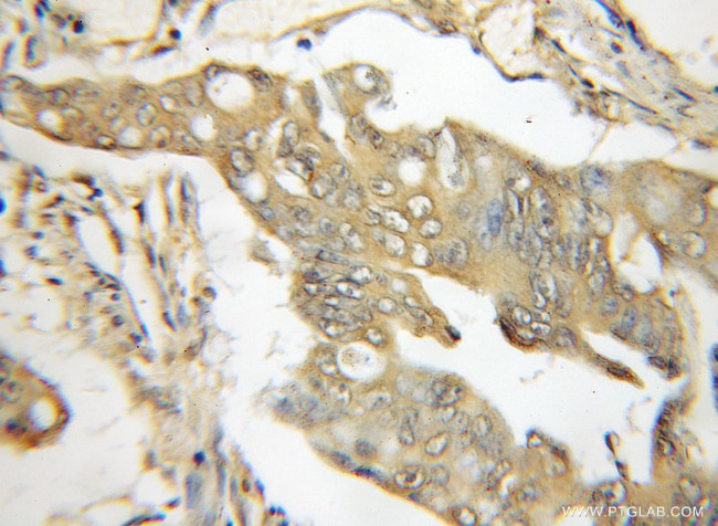 TRIM6 Antibody in Immunohistochemistry (Paraffin) (IHC (P))