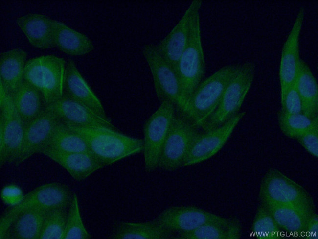 DYNLT1 Antibody in Immunocytochemistry (ICC/IF)