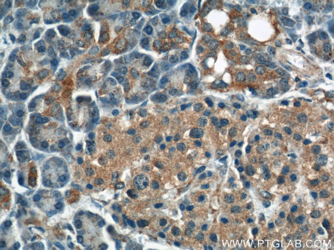 DYNLT1 Antibody in Immunohistochemistry (Paraffin) (IHC (P))